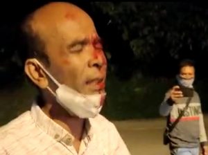 Viral Medsos!. Vidio Pria Berdarah di Penyekatan Perbatasan Padang Solok